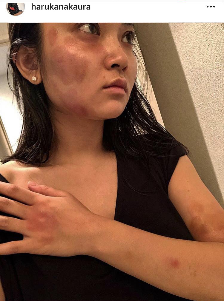 媒体聚焦女子被家暴不愿离婚现象，挑战与反思