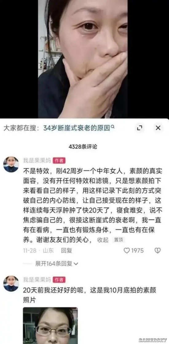 女生确诊渐冻症一年容貌巨变，逆境中的坚韧与希望之光