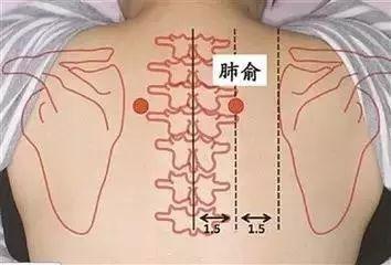 冬天中暑双肺变白，深度解析与应对策略