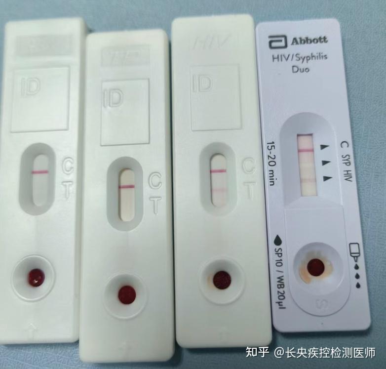 民宿惊现带血HIV试纸，安全与隐私的双重挑战！